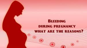 Of course you'll worry, but don't feel that your pregnancy can't still end well. Causes Of Bleeding During Pregnancy