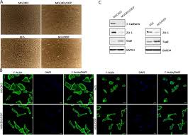 On the contrary, the development of cancer is a multistep process in which cells gradually become malignant through a progressive series of alterations. Cisplatin Resistance In Gastric Cancer Cells Is Associated With Her2 Upregulation Induced Epithelial Mesenchymal Transition Scientific Reports
