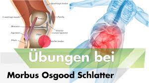 Morbus Schlatter Diese Ubungen Konnen Helfen Youtube