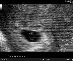 Le développement de la femme enceinte la période de fécondité d'une femme commence avant le 10ème jour du cycle (calculé à partir du premier jour des dernières règles) pour finir après le 17ème jour. 3e Semaine De Grossesse Famigros