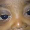 Take a closer look at the top five cancers found in children and the warning signs for each. Https Encrypted Tbn0 Gstatic Com Images Q Tbn And9gcrqlqikcbe6uni Cgznfr9j1ciw2efwrpx9vtcmw2k Usqp Cau