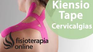 Aplicacion De Kinesiotaping Para Cervicalgias O Dolor De Cuello Youtube Vendaje Neuromuscular Dolor De Cuello Vendaje