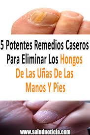 Hongos En Las Uñas De Las Manos Como Eliminarlos 5 Potentes Remedios Caseros Para Eliminar Los Hongos De Las Unas De Las Manos Y Pies Salud Hongos Consejos Para La Salud
