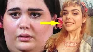 Doktorlar öleceğini söyledi; Hırs yaptı, 200 kilo verdi! Son hali tüm  dünyayı şaşkına çevirdi