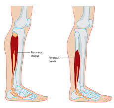 Start studying leg muscles (outside,bottom). Advice On Preventing Peroneal Shin Pain From Ski Boots