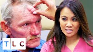 Pimple popper yanked out the biggest blackhead she's ever seen, leaving an asteroid crater. Man With Fear Of Doctors Gets Cyst Removed From His Face Dr Pimple Popper This Is Zit Youtube