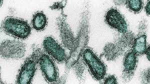 9 Virus Mematikan Di Dunia Ada Yang Berpotensi Wabah Di Indonesia