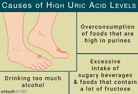 It forms ions and salts known as urates and acid urates, such as ammonium acid urate. Gout Causes Symptoms Diagnosis Treatment Emedihealth