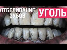 отбеливание зубов в домашних условиях без вреда для эмали 10 Naturalnyh Sposobov Otbelit Zuby V Domashnih Usloviyah Youtube Otbelit Zuby Zuby