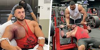 Please call or report your outage online. Video Shows Bodybuilder Suffering Gruesome Pec Tear Injury
