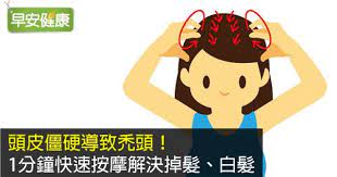早安健康 頭皮僵硬導致禿頭 1分鐘快速按摩解決掉髮 白髮 family guy fictional characters character