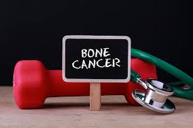 It destroys normal bone tissue. Bone Cancer Explained