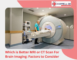 MRI or CT Scan: Which Is Best for Brain Imaging?