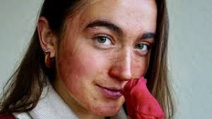 How can you make your period end faster? Abso Bloody Lutely Five Uses For Your Period Blood Every Month Dazed Beauty