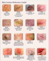 Pin On Nursing Books