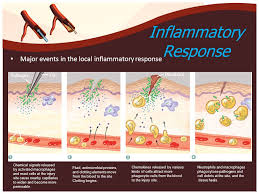 نتیجه جستجوی لغت [inflammatory] در گوگل