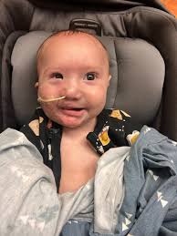 Deer with unusual ears in western Montana, USA