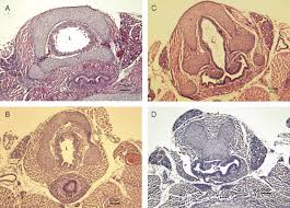 Maybe you would like to learn more about one of these? Adriamycin Produces A Reproducible Teratogenic Model Of Vertebral Anal Cardiovascular Tracheal Esophageal Renal And Limb Anomalies In The Mouse Journal Of Pediatric Surgery