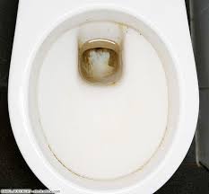 Urinstein Entfernen Wc Top 5 Hausmittel Im Vergleich