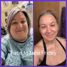 Gastric Sleeve and Bariatric Surgery Group ✓ Supporting The New You