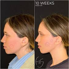 Todd Hanna, MD, DDS, FACS