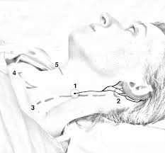 Image result for Ear Nerve Block