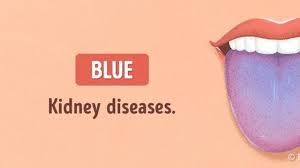 Maybe you would like to learn more about one of these? 8 Warna Lidah Yang Jelaskan Kondisi Kesehatan Anda Health Liputan6 Com