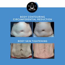 Related search › body sculpting training courses › clay sculpting classes near me train to become a certified body sculpting technician! Body Contouring Sacramento Body Sculpting Body Shaping