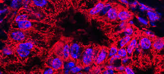 Most pancreatic cancers are exocrine cancers. Nerves Keep Pancreatic Cancer Cells From Starving Nyu Langone News