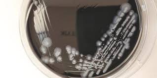 Elle est causée par la bactérie legionella, qui vit dans les sources d'eau naturelles et certaines installations, comme les tours de. Deux Nouveaux Cas De Legionellose Confirmes A Gand Portant Le Nombre De Victimes A 32 La Libre
