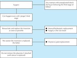 Image result for Uterine Inversion