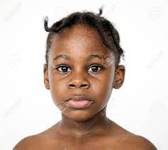 Kleine Afrikanische Mädchen Nackte Schest Studio Portrait Lizenzfreie  Fotos, Bilder Und Stock Fotografie. Image 76738820.