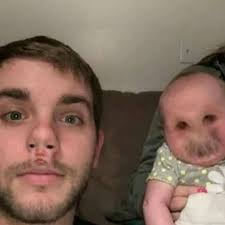 Klinger with a broken nose attempting to wake up Charles who was playing  dice with him.