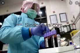 Produk dan jasa yang dimiliki kimia farma antara lain: Wakil Ketua Dewan Purwakarta Terkonfirmasi Positif Covid 19 Ternyata Otg