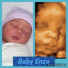 Directions from brooklyn to our 3d ultrasound facility. 3d Ultrasound 4d Ultrasound New York Ny Nyc Sono Baby Studio