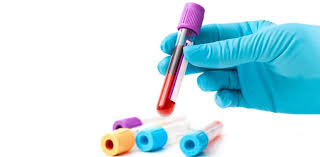 Ferritin Nedir Neye Yarar Dusuklugu Ve Yuksekligi Tehlikeli Midir