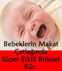 Bebeklerde Makat Catlagi Icin Krem Bebeklerde Makat Catlagi Belirtileri Bebeklerde Makat Catlagi Nedir Bebeklerde Makat Catl Bebek Menopoz Alternatif Saglik