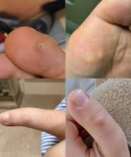 😲‼️You must be highly cautious. Getting this means you are infected with&hellip;.  Check the 1st comment⤵️