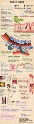 Crohn S Disease Medschool Doctor Medicalstudent Medicalschool Resources Step1 Study Inspiration School Crohns Disease Medical Education Nursing Notes