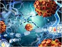 This definition means encephalitis is different from meningitis, which is defined as inflammation of the layers of tissue, or membranes, covering the brain.; Encefalitis Autoinmune