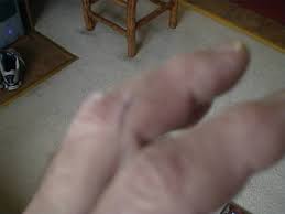 In christian churches, this practice is used as both a symbolic and formal method of invoking the holy spirit primarily during baptisms and. How To Remove Betadine From The Skin