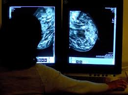 It's more common for them to be a cyst (a sac) or a fibroadenoma (an abnormal growth that's not cancer ). Breast Cancer Survey Finds Almost Half Of Women Do Not Regularly Examine Themselves The Independent