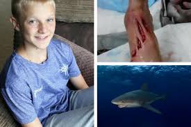 If we're going to talk about the bull shark's diet, we need to break it up into the freshwater menu and the saltwater menu. Balerno Schoolboy Shane Mcconnell Tells Of His Shark Attack Ordeal In The Bahamas Heraldscotland