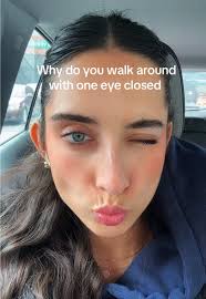 Understanding Heterochromia and Its Visual Impact