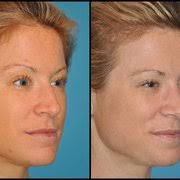 BARRY M. WEINTRAUB MD