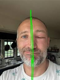 Looking for reputable botox treatment for TMJ/migraine issues