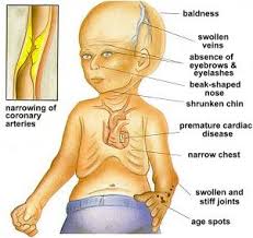 The Reality Of The Curious Case Of Benjamin Button An Ageing Backward Disease Brainerves