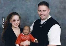 White Mommy White Daddy Black Baby Black Eye 9gag
