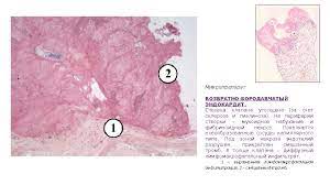 Полезная информация на медицинском портале med74.ru челябинск: Revmaticheskie Bolezni æ—©æ—©æ—©æ—© é¢¨é¢¨é¢¨é¢¨é¢¨ Zabolevaniya Soedinitelnoj
