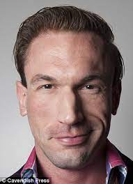Dr christian opens up about suffering from depression and muscle dysmorphia | loose women. Embarrassing Bodies Dr Christian Jessen Has Wayne Rooney Hair Implants After Twitter Mocks Bald Patch Daily Mail Online